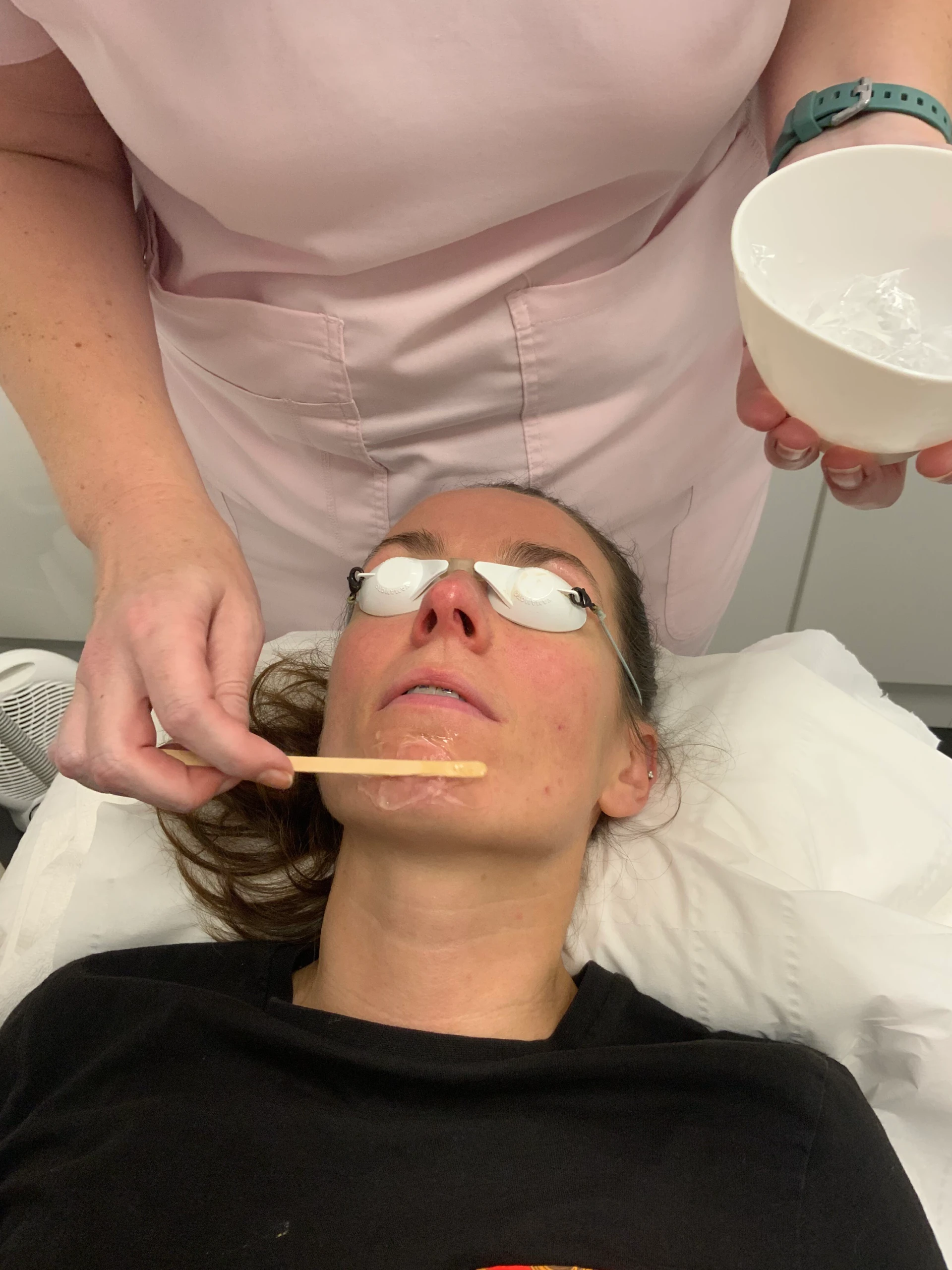 Patient with protective eyewear receiving facial peel applied by clinician.