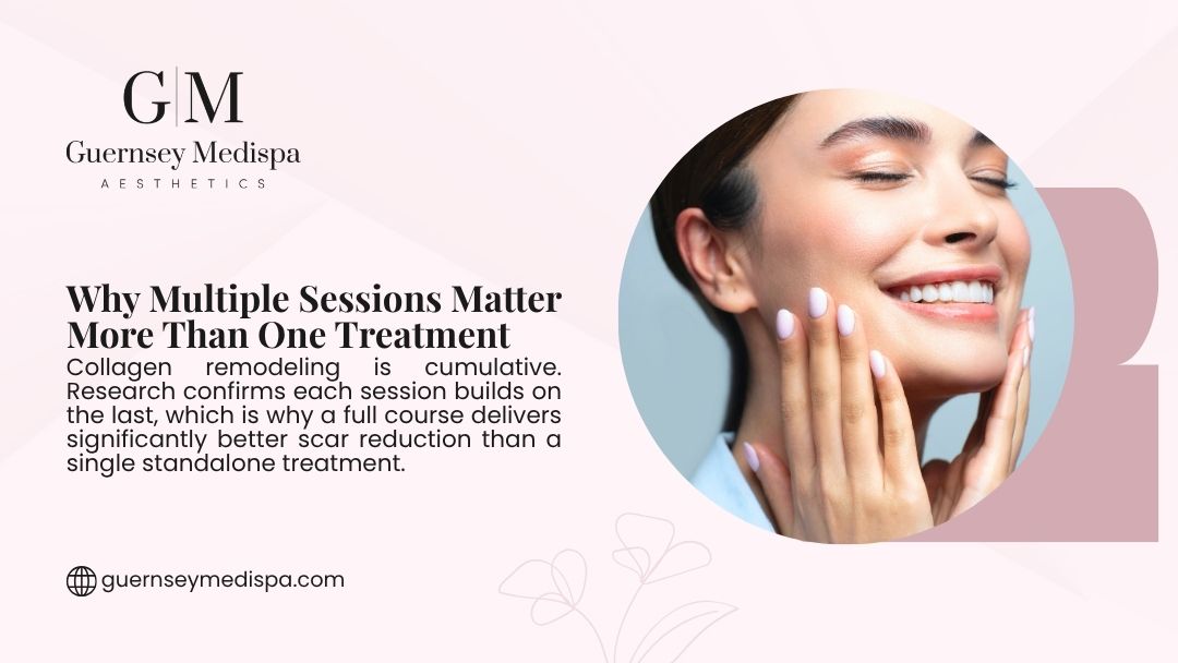 A glowing woman smiles while touching her smooth face, illustrating why multiple microneedling sessions matter more than a single treatment.