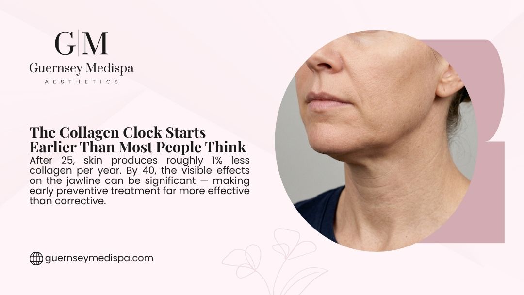 Guernsey Medispa infographic showing a woman's jawline with visible collagen loss, noting skin produces 1% less collagen per year after 25, making early preventive treatment more effective.